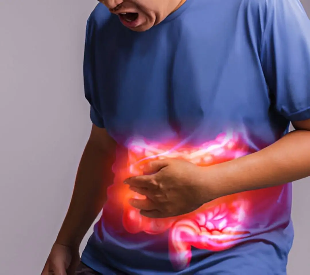 Irritable Bowel Syndrome (IBS) Treatment